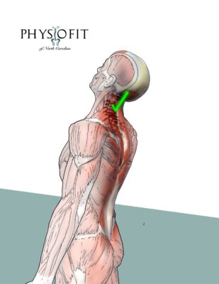 6 Green Zones Cervical